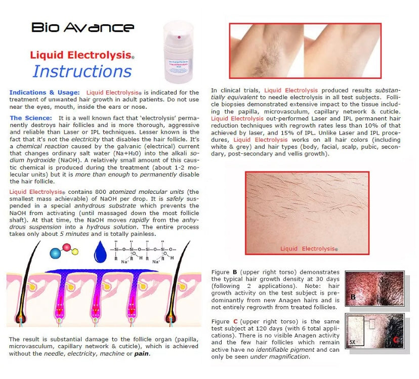 Liquid Electrolysis for Permanent Hair Removal, Pain-Free, Indulgent, Luxurious Bouquet, 30ml Bottle